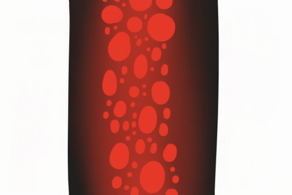 Santana | Advanced Oracalion MYO