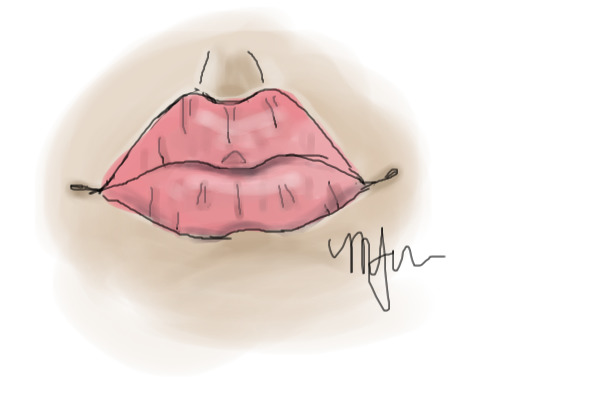 Cherry lips