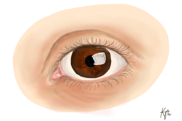 Brown Eye