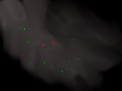 hiccen fog